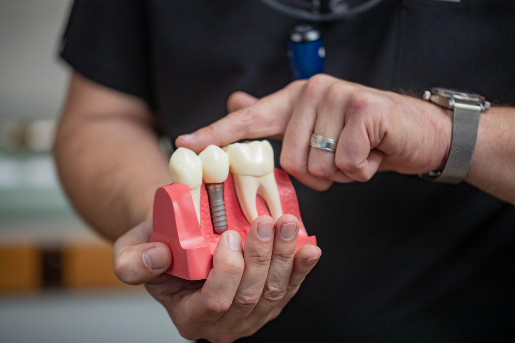 Dental Implant Restoration: Prosthetic Root and Crown - Trophy Smile Studio  Trophy Club Texas